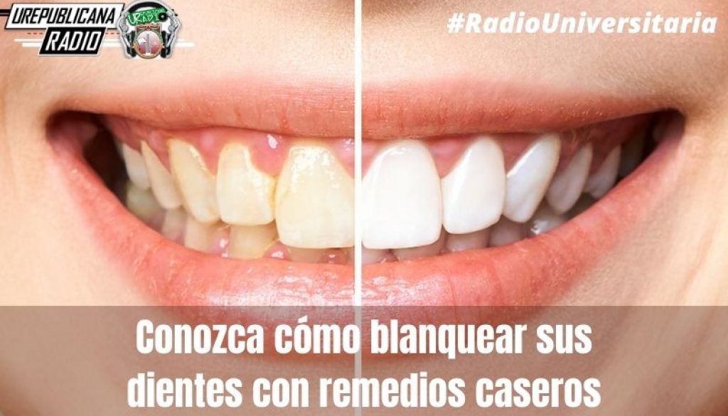 Conozca_cómo_blanquear_sus_dientes_con_remedios_caseros_URepublicacanaRadio_emisora_radio_universitaria_estudiar_bogota_colombia