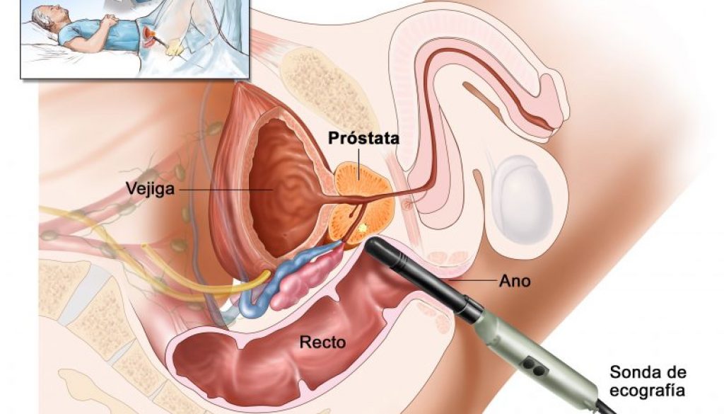 curso-cancer-prostata-urepublicanaradio-2021