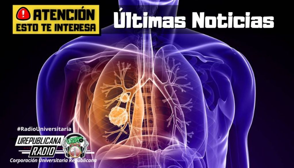 smog_promueve_cambios_cancerosos_cancer_de_pulmon_no_solo_se_da_en_fumadores_noticias_ureblicanaradio_emisora_radio_universitaria_bogota_colombia